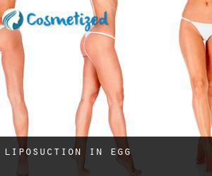 Liposuction in Egg