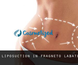 Liposuction in Fragneto l'Abate