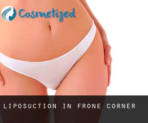 Liposuction in Frone Corner