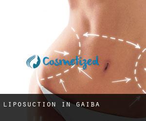 Liposuction in Gaiba