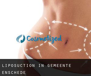 Liposuction in Gemeente Enschede