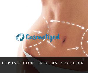 Liposuction in Ágios Spyrídon