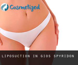 Liposuction in Ágios Spyrídon