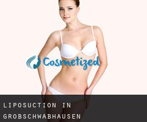 Liposuction in Großschwabhausen