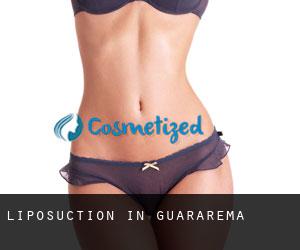 Liposuction in Guararema