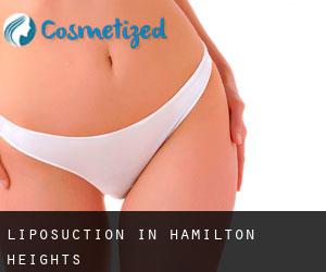 Liposuction in Hamilton Heights