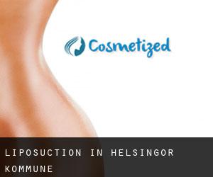 Liposuction in Helsingør Kommune