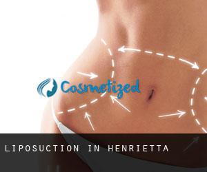 Liposuction in Henrietta