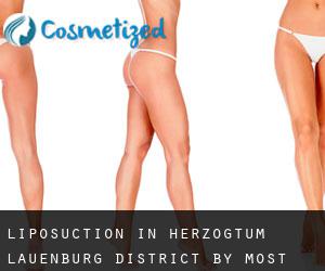 Liposuction in Herzogtum Lauenburg District by most populated area - page 2