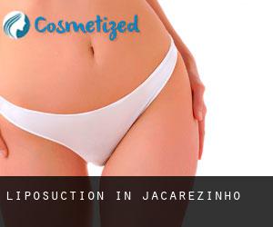 Liposuction in Jacarezinho