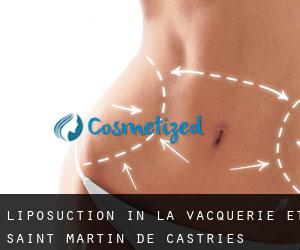 Liposuction in La Vacquerie-et-Saint-Martin-de-Castries