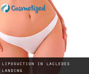 Liposuction in Lacledes Landing