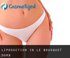 Liposuction in Le Bousquet-d'Orb