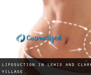 Liposuction in Lewis and Clark Village