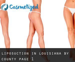 Liposuction in Louisiana by County - page 1