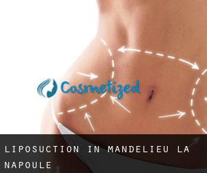 Liposuction in Mandelieu-la-Napoule