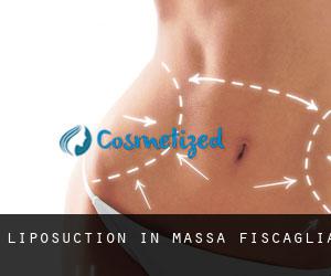 Liposuction in Massa Fiscaglia