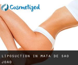 Liposuction in Mata de São João