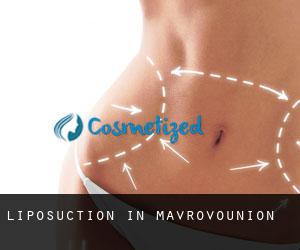 Liposuction in Mavrovoúnion