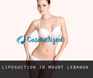 Liposuction in Mount Lebanon