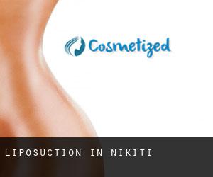 Liposuction in Níkiti