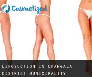 Liposuction in Nkangala District Municipality