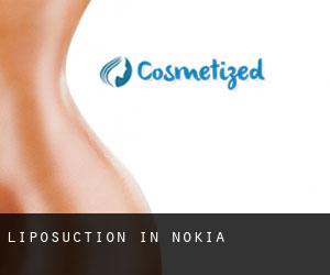Liposuction in Nokia
