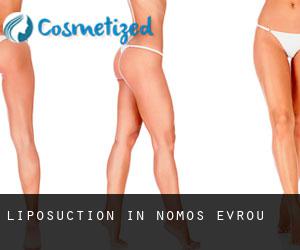 Liposuction in Nomós Évrou