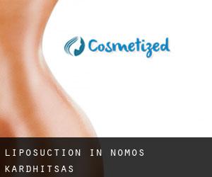 Liposuction in Nomós Kardhítsas