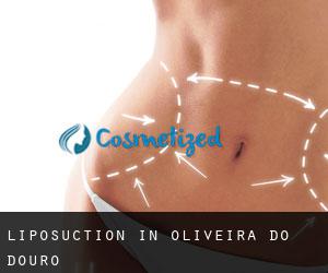 Liposuction in Oliveira do Douro