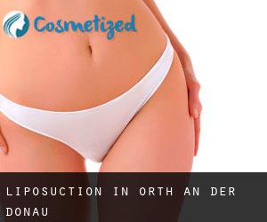 Liposuction in Orth an der Donau