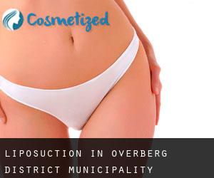 Liposuction in Overberg District Municipality