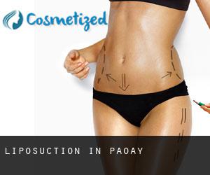 Liposuction in Paoay