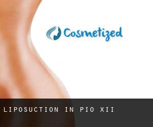 Liposuction in Pio XII