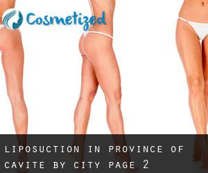 Liposuction in Province of Cavite by city - page 2