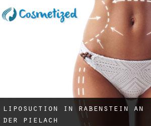 Liposuction in Rabenstein an der Pielach