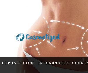 Liposuction in Saunders County