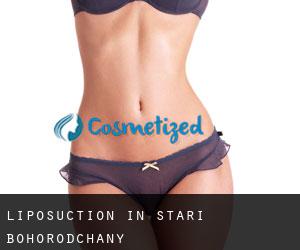 Liposuction in Stari Bohorodchany