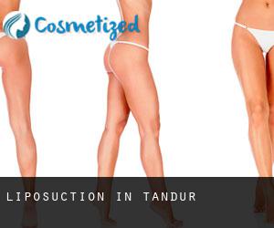 Liposuction in Tandur
