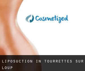 Liposuction in Tourrettes-sur-Loup