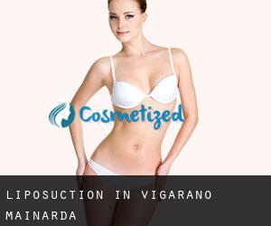 Liposuction in Vigarano Mainarda