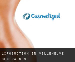 Liposuction in Villeneuve-d'Entraunes