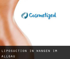 Liposuction in Wangen im Allgäu