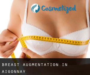 Breast Augmentation in Aigonnay