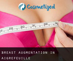 Breast Augmentation in Aigrefeuille