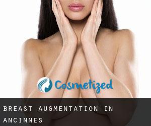 Breast Augmentation in Ancinnes