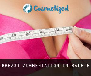 Breast Augmentation in Balete