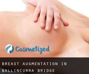 Breast Augmentation in Ballincurra Bridge