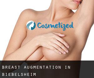 Breast Augmentation in Biebelsheim