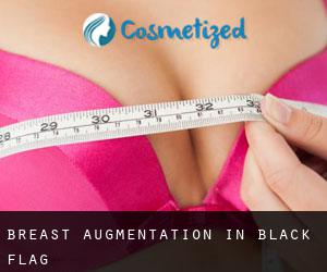 Breast Augmentation in Black Flag
